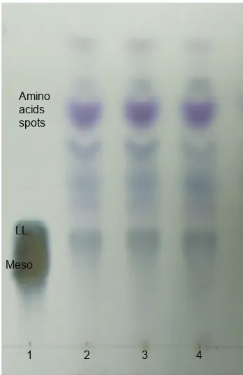 Figure 1 neighbor-joining tree showing the relationship of strain sUK 25 based on a 16s rrna gene sequences (1,450 nucleotides with closely related members of the genus Streptomyces omiyaensis nBrc 13449T and Kitasatospora setae KM-6054 as the outgroup).Abbreviations: sUK 25, strain Universiti Kebangsaan 25; rrna, ribosomal rna.