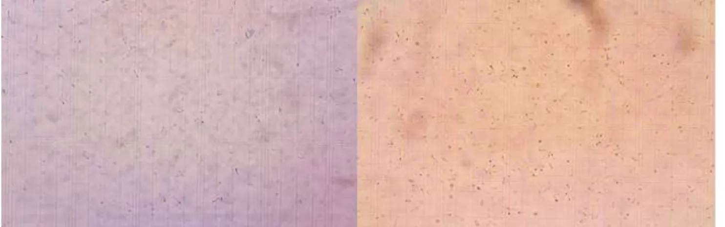 Figure 1: Examples of FOVs for the sperm counts from out study: Group E (left) and Group C (right) 