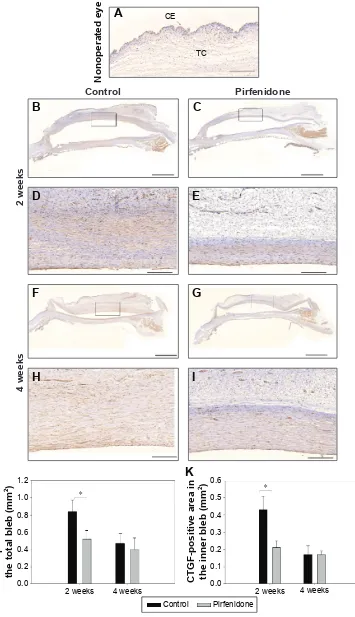 Figure 5 immunohistochemical micrographs for cTgF.Notes: cTgF scarcely stained the normal Tenon’s capsule in the nonoperated eye (A)