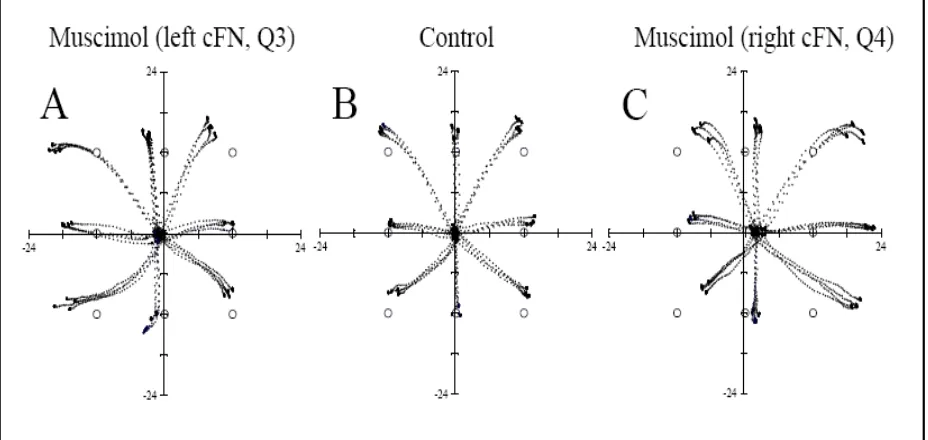 Figure 2.6: Effects of unilateral FOR inactivation on visually guided saccades. 