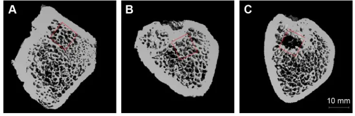 Figure 5 Various peptide hydrogels enhance bone healing and bone morphology change at 8 weeks.Notes: (A) d-raDa16-rgD hydrogel, (B) bFgF-incorporated d-raDa16-rgD hydrogel, and (C) PBs (ph 7.4)