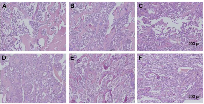 Figure 7 Osteogenic observation of various peptide hydrogels 8 weeks after implantation.Notes: Morphometric analysis of (A) BV/TV, (B) BMD, and (C) Tb Th, group 1: d-raDa16-rgD hydrogel + PBs (ph 7.4), group 2: d-raDa16-rgD hydrogel + bFgF, and Group 3: PB