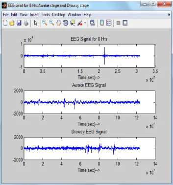Fig 3:- Total sleep signal,awake EEG signal, Drowsy EEG signal     