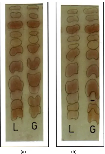 Figure 3. Paper chromatograph showed separation of free amino acids from seeds from seeds extracts (a) and root extracts (b) of bean cultivars