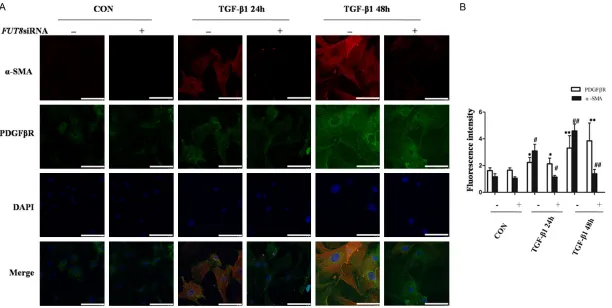 Figure 7. Effect of FUT8siRNA on TGF-β1-induced pericyte transformation. A: An immunofluorescence double staining method was used to detect PDGFβR and α-SMA protein expression in each group