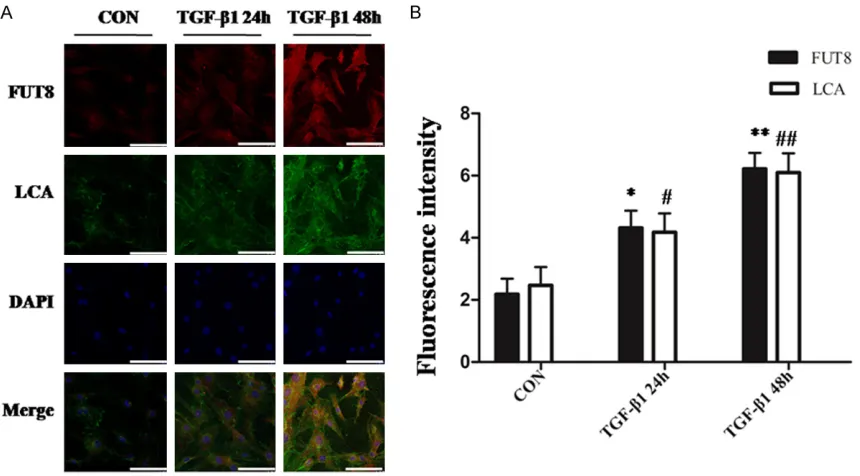 Figure 3. FUT8siRNA successfully silencing the FUT8 gene in pericytes. A: Apply immunoblotting to detect the efficiency of interference