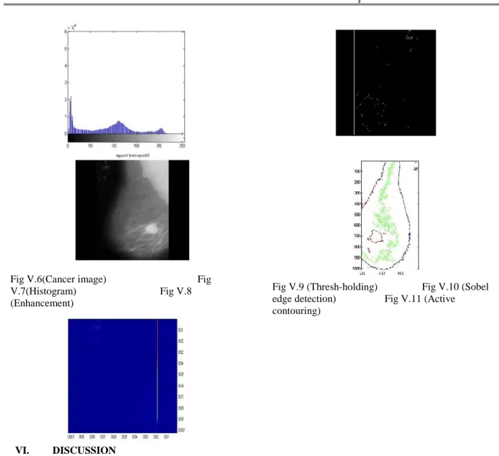 Fig V.6(Cancer image) Fig