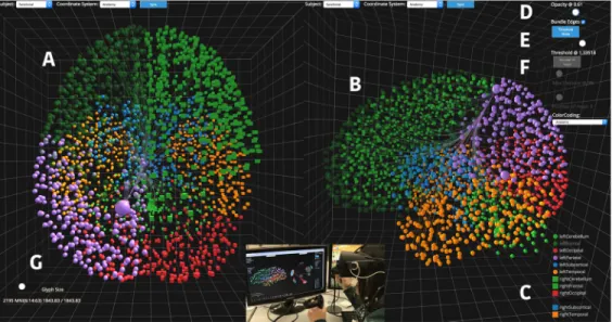 Figure 1. The user interface of NeuroCave, presenting multiple views to investigate connectome data