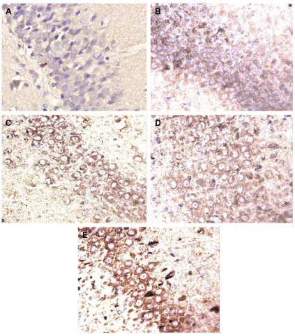 Table 5 effects of microspheres on the expression of PKc-δand iba1
