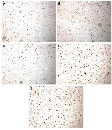 Figure 9 effects of cTs/Pl/β-cD microspheres on the quantities of iba1 in the hippocampus by immunohistochemistry staining (light microscope, ×400).Notes: (A) control group, (B) high-dose group, (C) medium-dose group, (D) low-dose group, and (E) model group.Abbreviations: cTs, chitosan; Pl, phospholipid; β-cD, β-cyclodextrin; iba1, ionized calcium-binding adaptor molecule-1.