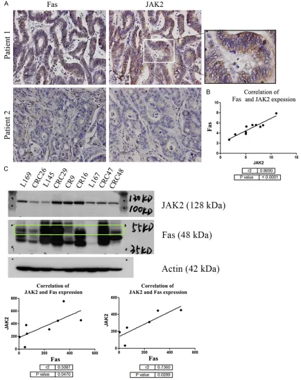Figure 5. Correlation of JAK2 and FAS in CRC primary tumors and CRC cell lines. A. Examples of immunohistochem-istry pictures show FAS (left two panels) and JAK2 (right two panels) expression in two patients