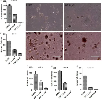 Figure 6. Clone formation capacity was assayed in different cell lines CRC29, L145, CR9, CR16, and CRC48
