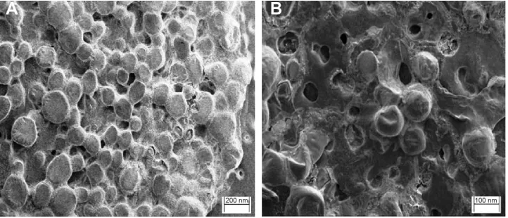 Figure 2 seM micrographs of the prepared liposomes of DnP.Note: Micrographs at a scale of 200 nm (A) and 100 nm (B).Abbreviations: seM, scanning electron microscopy; DnP, donepezil.