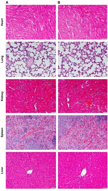 Figure 6 histopathological examinations of heart, lung, kidney, spleen, and liver.Notes: Sections were processed with hematoxylin and eosin stain for the analysis of level of inflammation and morphology of the tissues