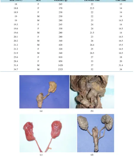 Table 1. The table shows the age and the fetal parameters in anencephalic fetuses. The fetuses studied ranged in age between 18 to 22 WPC, weighted between 170 and 420 g, and had crown-rump length between 13 and 16.5 cm