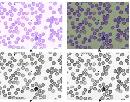 Fig 4: (A) Original image, (B) Background corrected image, (C) Contrast enhanced image, (D) Noise removed 