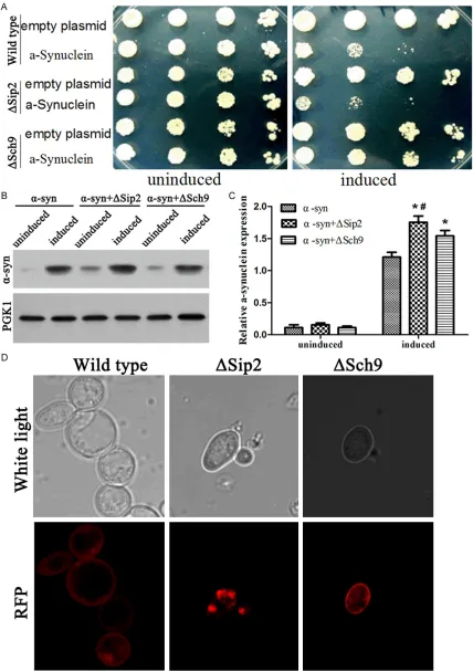 Figure 6. Effect of ΔSip2 and ΔSch9 on the α-syn toxicity, aggregation and ROS level in yeast