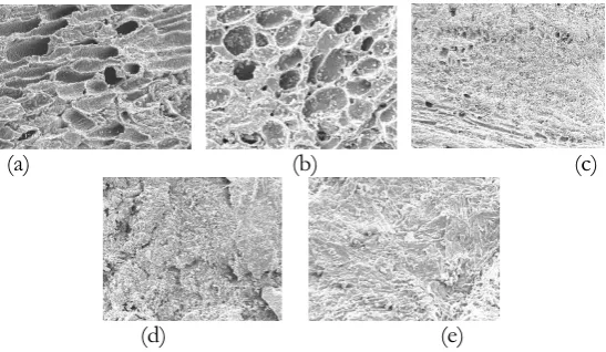 Fig. 8. SEM images of activated carbon (AC2) impregnated with different concentrations of NaOH solution, (a) 0 wt% NaOH, (b) 3wt%, (c) 5wt%, (c) 8wt%, and (e)15wt%