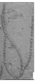 Figure 3 Image Cyanobacteria corrupted by Gaussian noise. (a) Noise with variance 0.02 (b) Noise with variance 0.03 (c) Noise with variance 0.04 (d) Noise with variance 0.05  