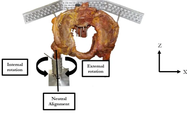 Fig. 11. Direction of internal rotation and external rotation from neutral alignment.  
