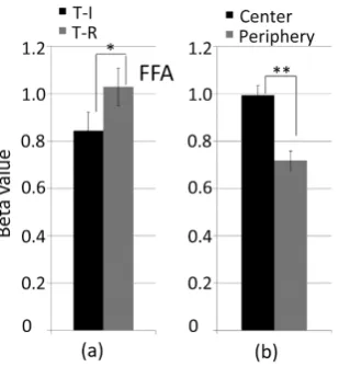 Figure 4. Averaged responses of three stimulus conditions of S, SP and DP. **: p < 0.001