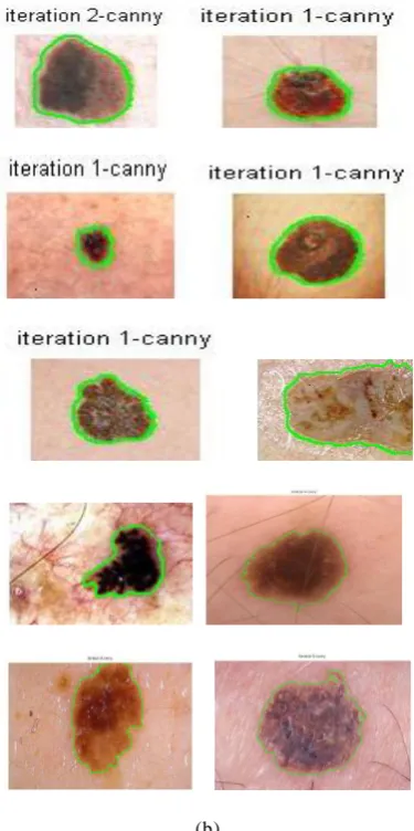 Fig 2: Original images referred from [8], [9], [16], [17], [18] 