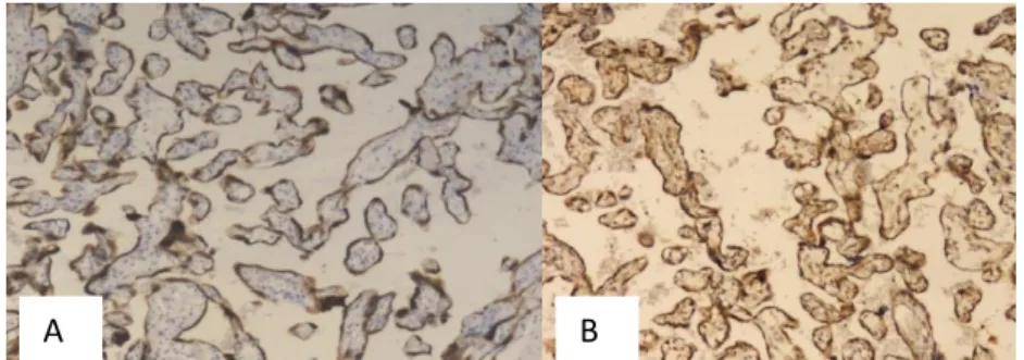 Figure 1. Bcl-2 (A) and Beclin-1 (B) Immunoexpression, Score 6 (Strongly Positive), Magnification 100x, in Normal Placenta 