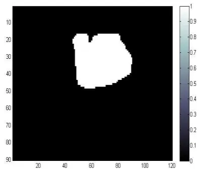 Fig 3: Segmented image