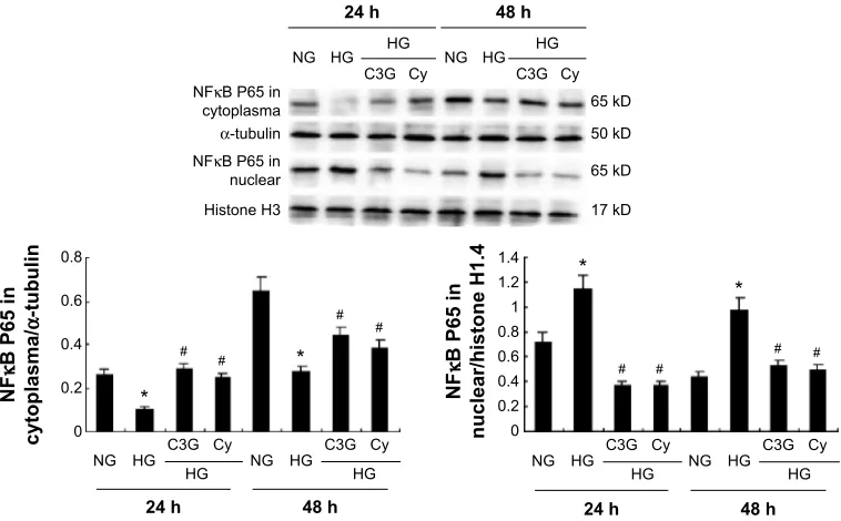 Figure 8 effects of gW6471 and plV-nr1h3-shrna plasmid on anthocyanins-mediated reduction of McP1, icaM1, and TgFβ1 in hK-2 cells.Notes: (A) The expression levels of McP1, icaM1, and TgFβ1 protein were detected by Western blot