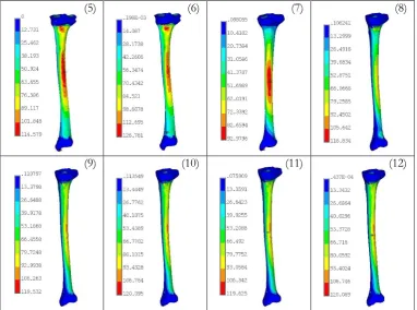 Fig. 12. Von Mises stress distribution (MPa) on tibia surface of female and male for case studies 1-12
