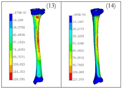 Fig. 13. Von Mises stress distribution (MPa) on tibia surface for case studies 13 and 14