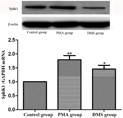 Figure 3. Effect of DMS and PMA on cell apoptosis in human pancreatic cancer SW1990 cell