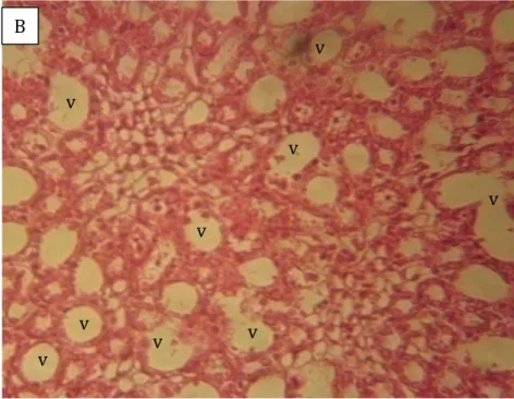 Figure 8: Histological section of rats kidney fed with diets containing proportion of Blighia sapida aril powder   A: Diets containing lower level of Blighia sapida aril powder (0 %; 6.25 %; 12.5 %; 25 %): kidneys tissues are not 