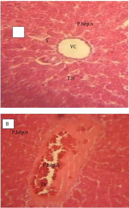 Figure 7: Histological section of rats liver fed with diets containing  proportion of Blighia sapida aril powder 
