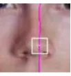Figure 11: Nose bridge detection with the SSR filter and the horizontal profile. 