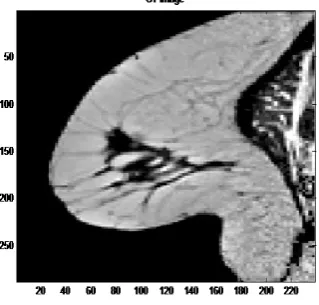 Fig 1. Shows Input Of CT Image of Breast 