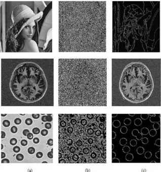 Fig.. 11.  (a)  Original Image  (b) Result of Watershed Segmentation (c) Result of Proposed algorithm 