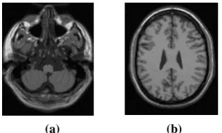 Fig. 2: (a) T1 simulated brainweb image slice no. # 20        (b) T1 simulated brainweb image slice no