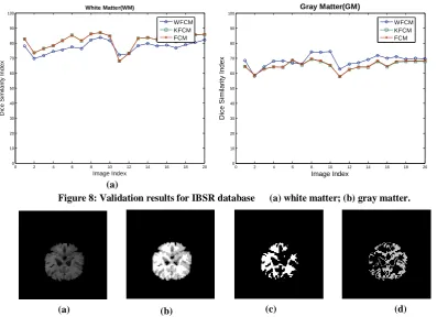Figure 8: Validation results for IBSR database      (a) white matter; (b) gray matter
