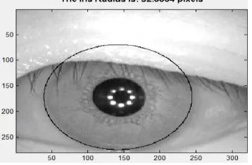 Figure 6: Accurate estimation of radius of image S1011L07 from CASIA interval version 3 database 