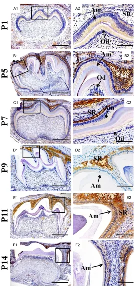 Figure 1. KLK4 expression in mouse molar germs. The immunohisto-chemistry results of KLK4 expression for P1 (A1, A2), P5 (B1, B2), P74 (C1, C2), P9 (D1, D2), P11 (E1, E2) and P14 (F1, F2), respectively