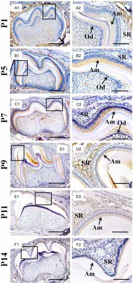Figure 2. CTSC expression and DPPI distribution in mouse molar germs. The immunohistochemistry results of DPPI distribution in P1 (A1, A2), P5 (B1, B2), P7 (C1, C2), P9 (D1, D2), P11 (E1, E2) and P14 (F1, F2), respectively