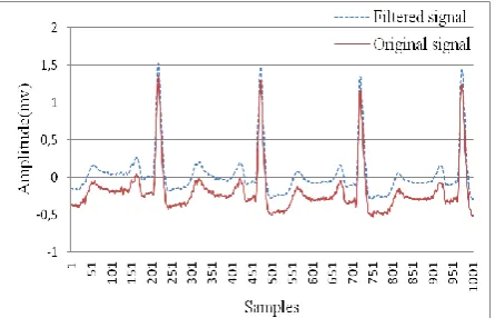 Fig.2 Patterns of NSR (record 100 of MIT-BIH database)