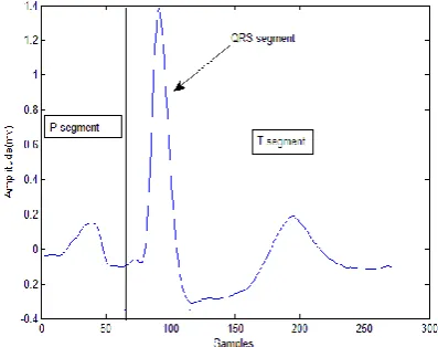 Table 1: Samples of features vectors of the six ECG types 