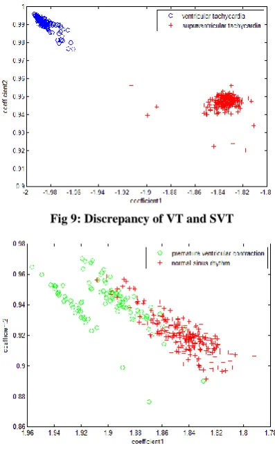 Fig 9: Discrepancy of VT and SVT 