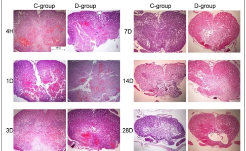 Fig. 2 HE staining comparison between groups C and D. The pathological changes were similar between groups C and D from 4 h to 3 DPI.However, from 7 to 28 DPI, more white matter was spared and fewer vacuoles were observed in group D (HE staining, ×40; bar = 200 μm)