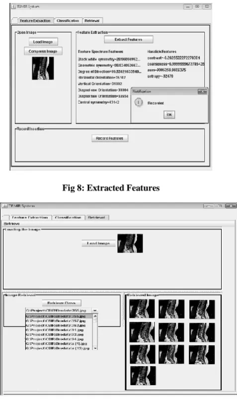 Fig 8: Extracted Features  
