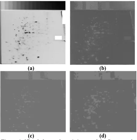 Figure 6: 2D gel electrophoresis image of the first sample of Patient- Human leukemias (a) Original image, (b) Gradient image, (c) Gradient image after applying FCM segmentation algorithm, and (d) Gradient image after RFCM segmentation algorithm  