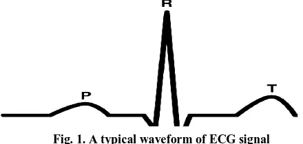 Fig. 1. A typical waveform of ECG signal 