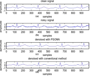 Fig. 4. Test results with pseudo-clean ECG signal 